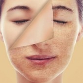 Lưu ý dưỡng da mùa hanh khô